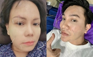 Bị liệt cơ mặt giống Hari Won, Việt Hương: Nam MC tiết lộ sự nguy hiểm của bệnh