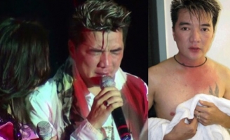 Ca sĩ bị hành hung, đánh hội đồng khi đi hát và muôn vàn tai nạn oái oăm “khó đỡ”