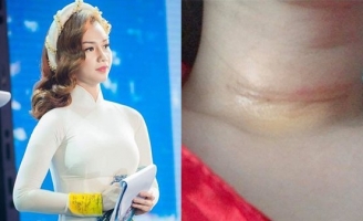 MC Quỳnh Chi phải phẫu thuật vì tế bào ung thư xâm lấn