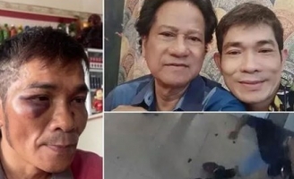 Nguyên nhân con trai danh ca Chế Linh bị đánh hội đồng đến bất động