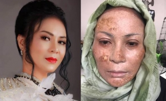 Ôn Bích Hằng không ngại xấu xí trong phim điện ảnh ‘Kẻ Đào Mồ’